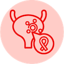 Bladder Cancer