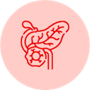 Pancreatic Cancer