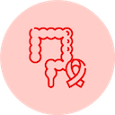 Rectal Cancer
