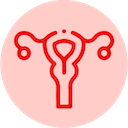 Uterine Fibroids